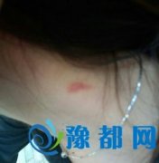 17qкŮǺۆ װl(f)ʲô